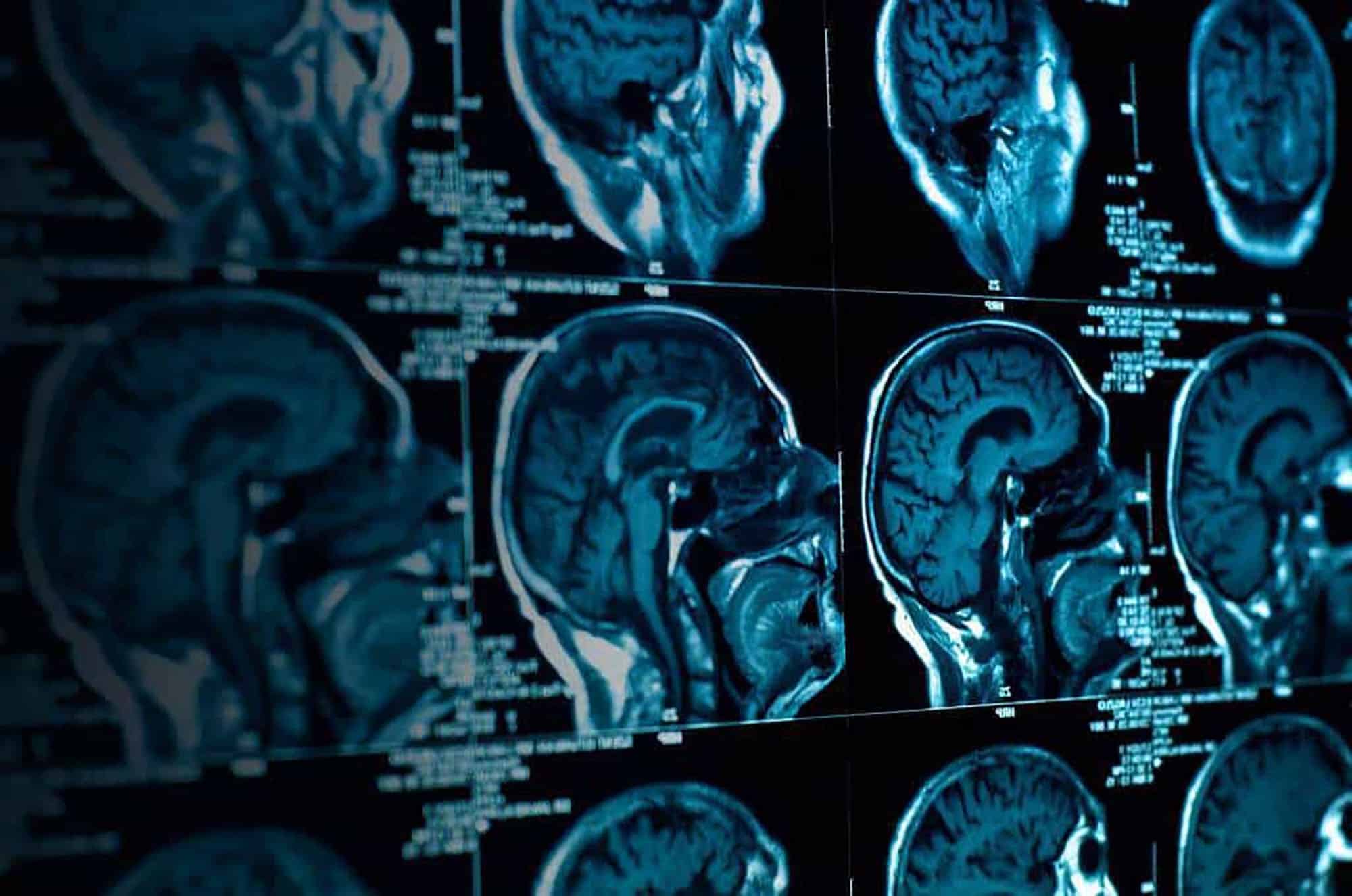 Brain scans used while earning an associate degree in Behavioral Science